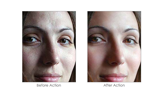 Soften Skin Effect